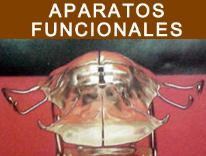 Aparatos Funcionales